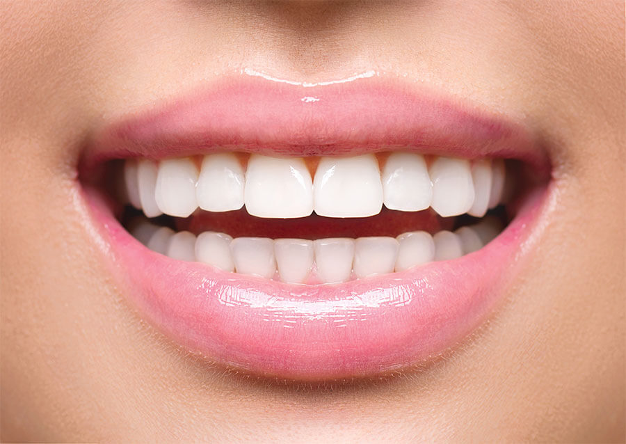 Moduri ușoare de menținere a dinților sănătoși și albi strălucitori
