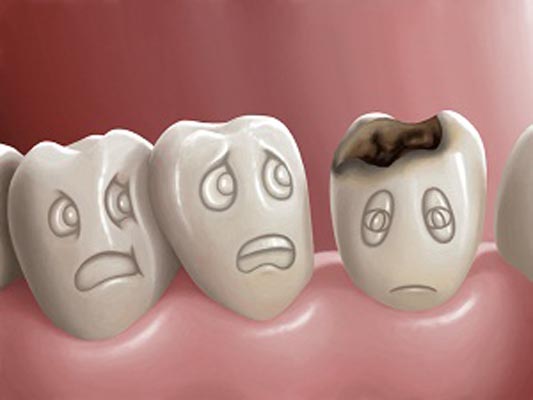 De ce este bine să descoperi cariile dentare din timp?